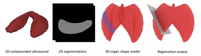 Illustration dexcribing the project Partial 3D Thyroid Registration using GCN